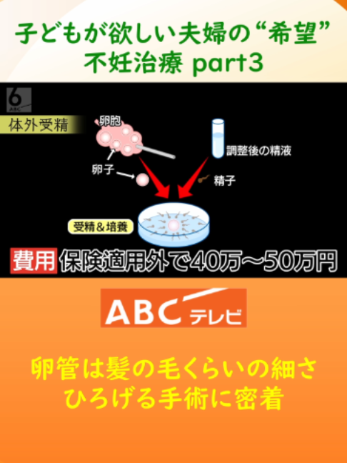 @ABCニュース