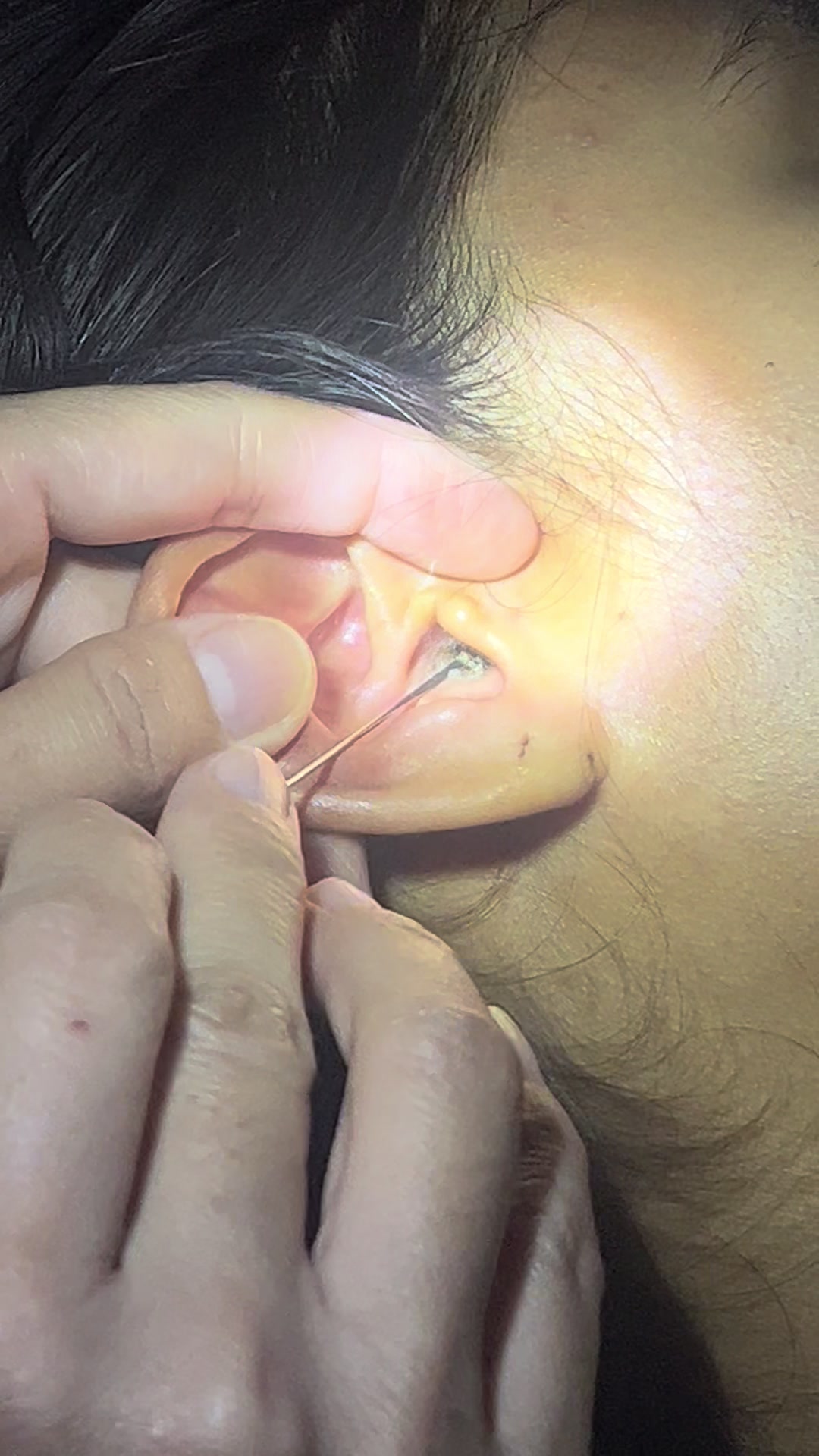 @ហាង សំអាតត្រចៀក 081 674455