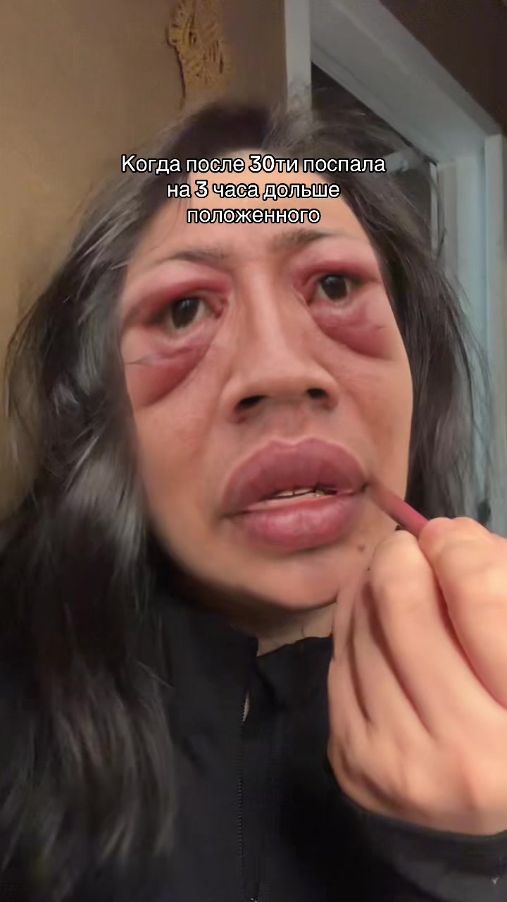 @xenyas