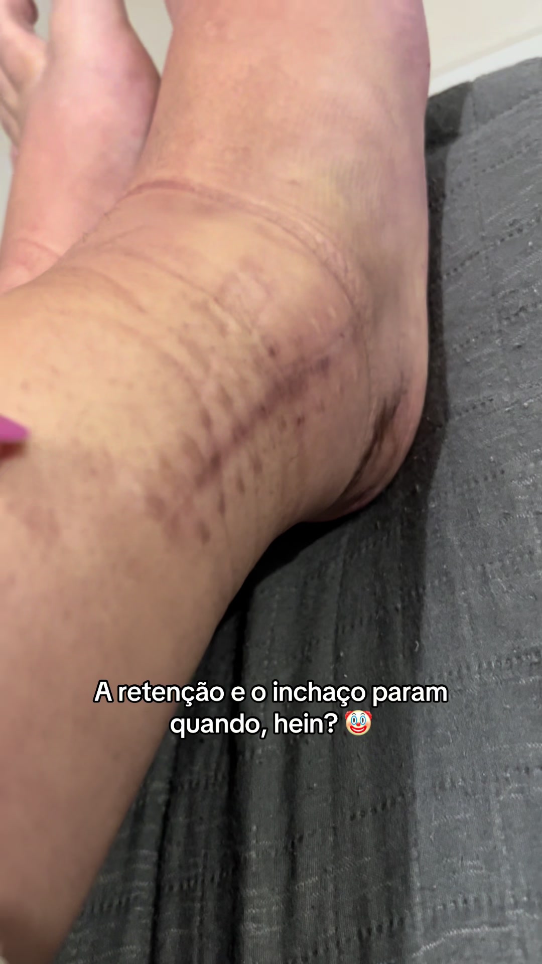 @Ana