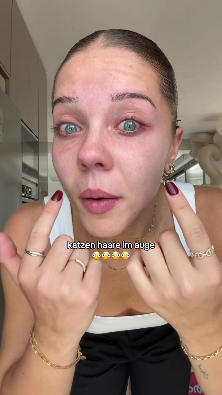 @zana