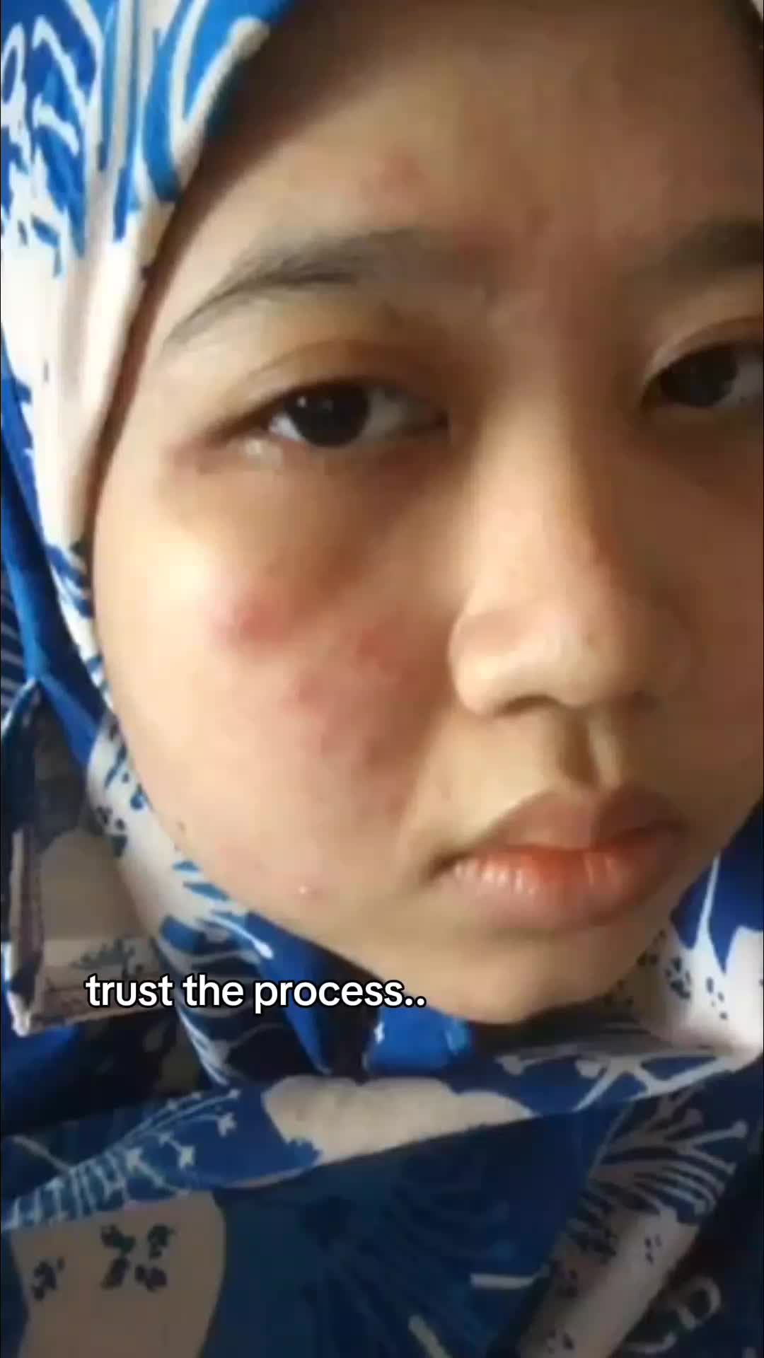 @AINAANIDA