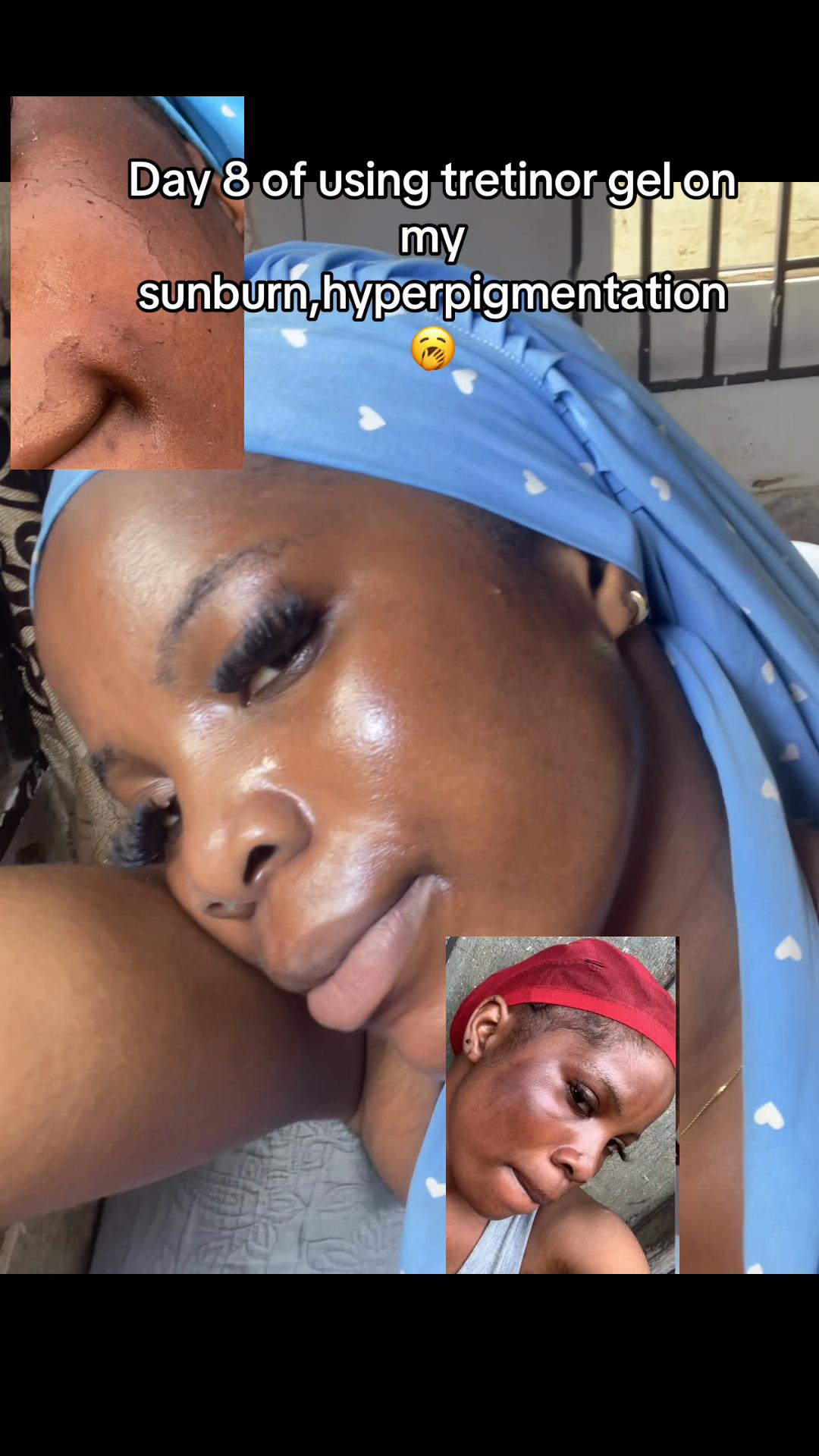 @꧁༆Kween Tolex🥹💕🦋🌸 ༆꧂