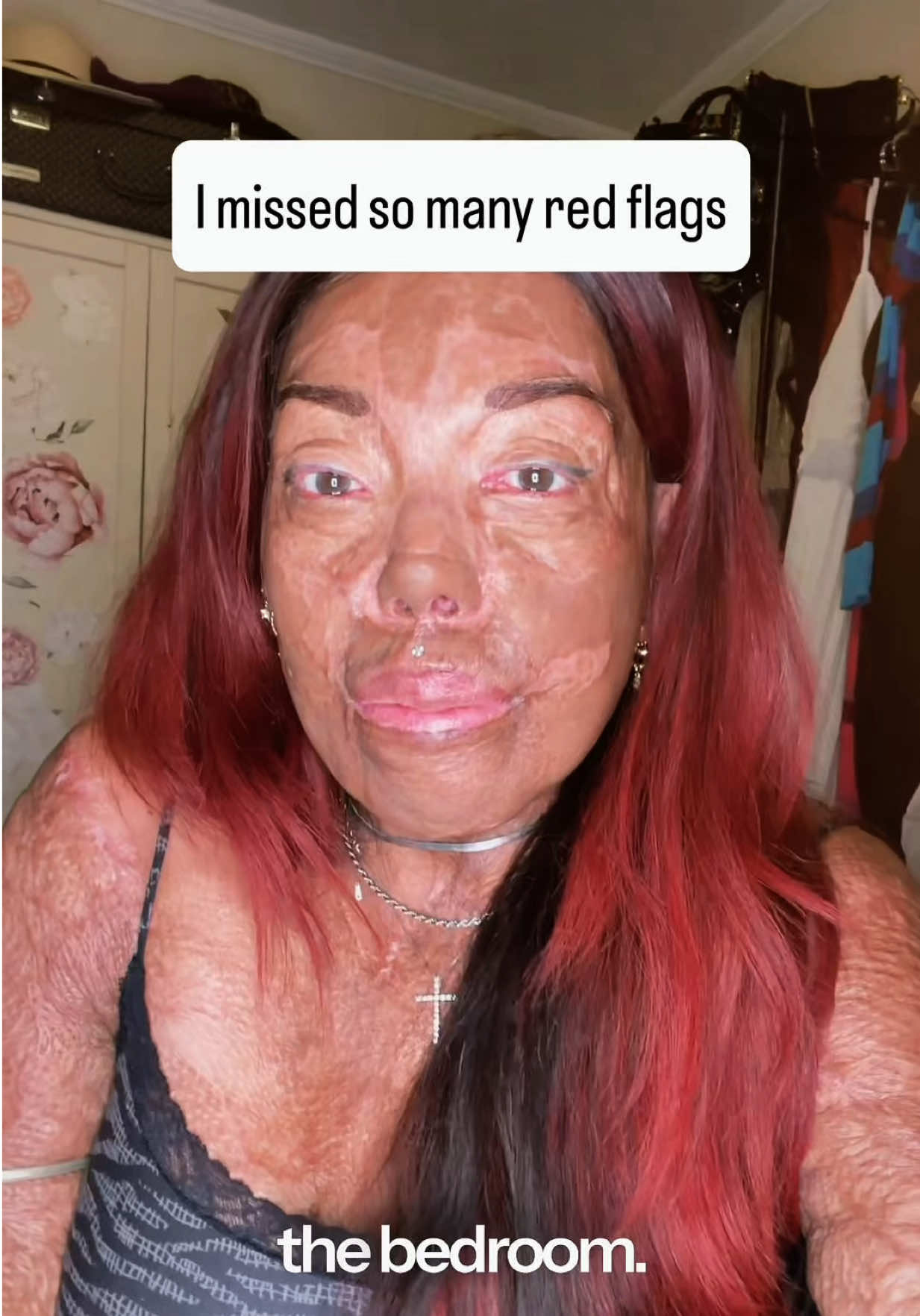 @Burned Beauty 2018®️