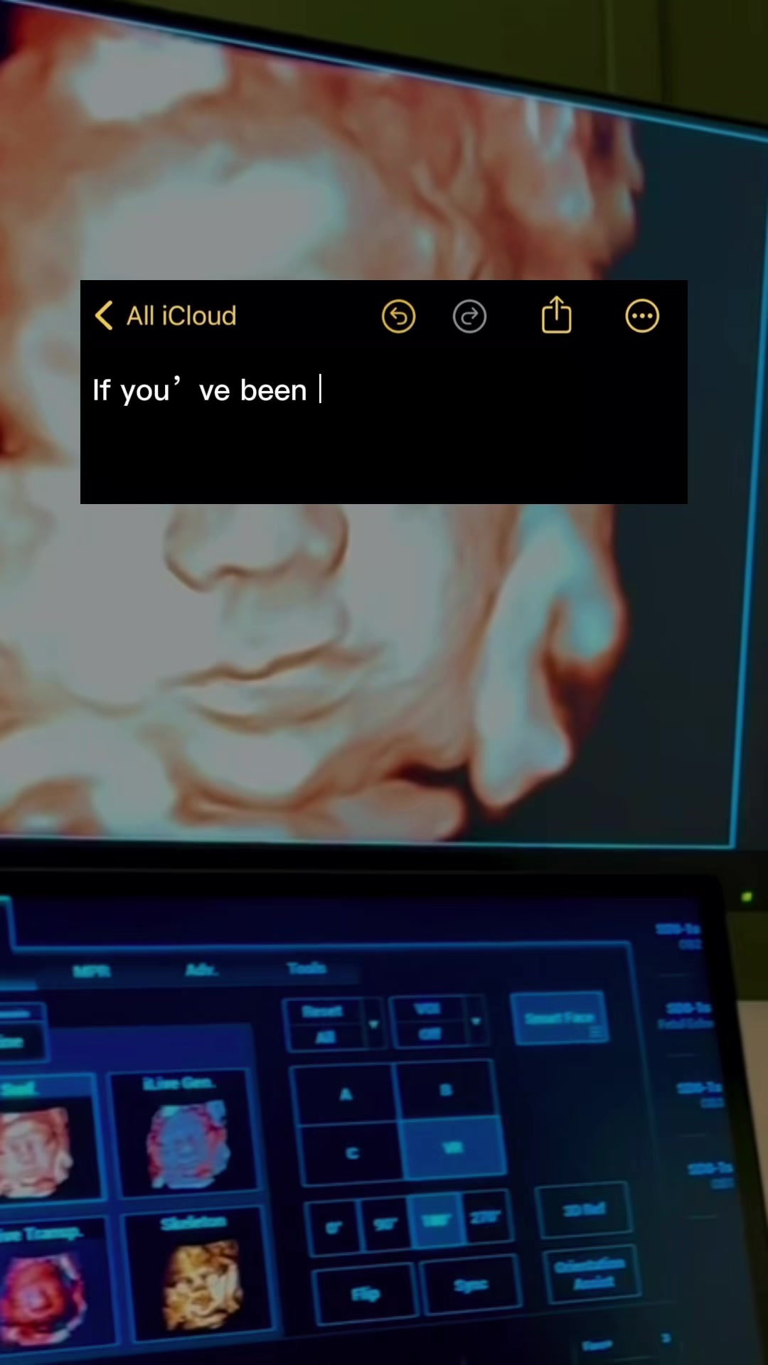 @babyspace3d4d