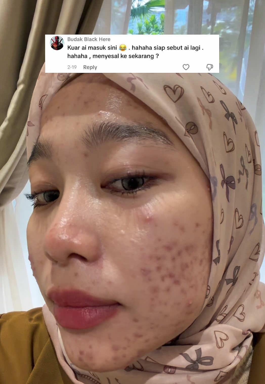 @AINAA