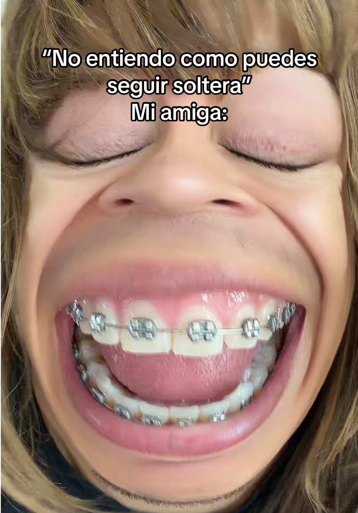 @AntonNarvaez