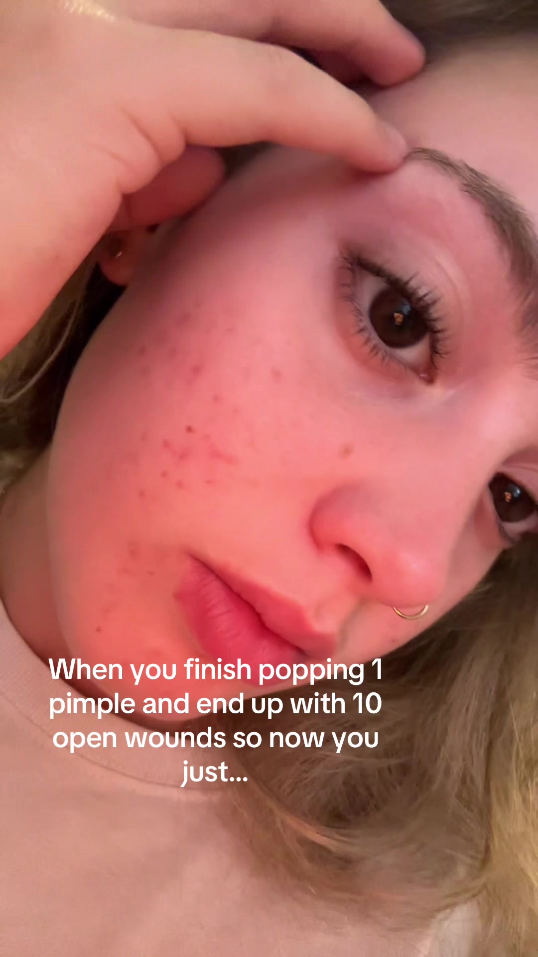@cheeto🙈