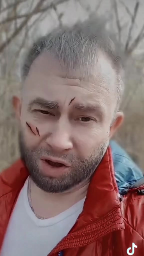 @𝕆ℙ𝕋𝕀𝕄𝕀𝕊𝕋