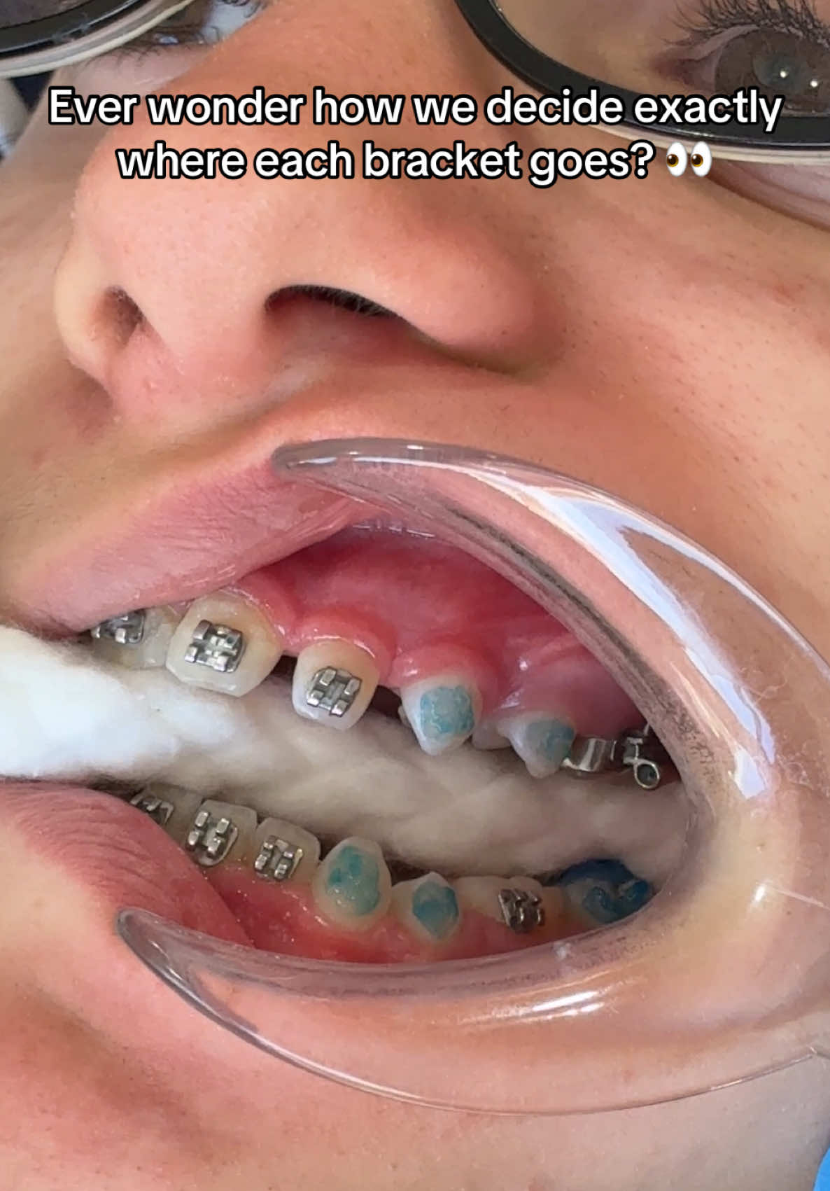 @Woodland Hills Orthodontist