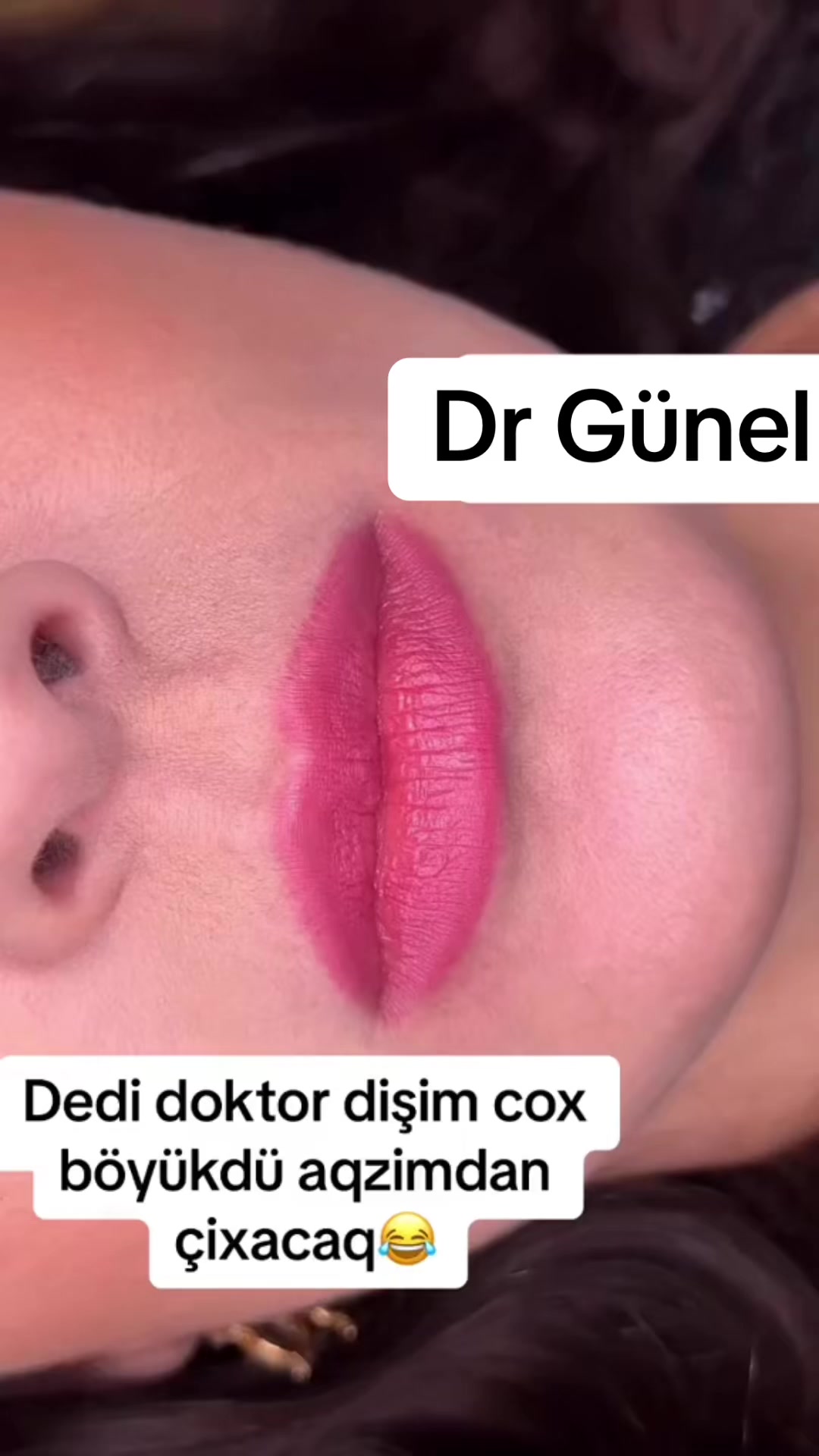 @Dentist_Günel