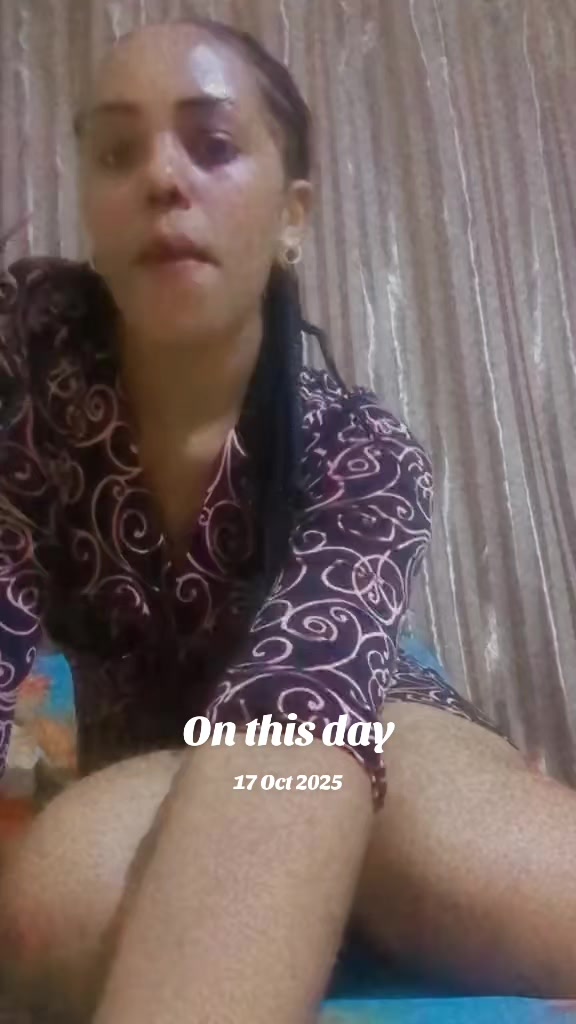 @Prossy