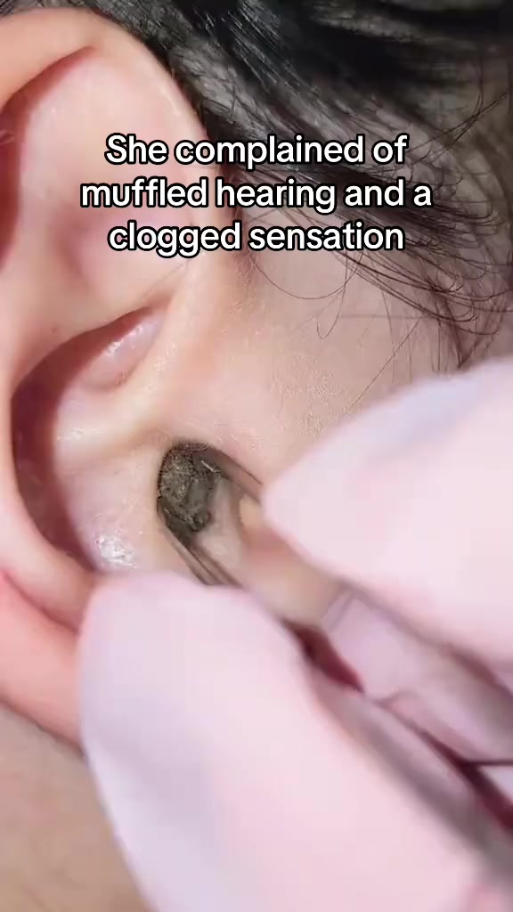 @Satisfying Ear Cleaning Videos