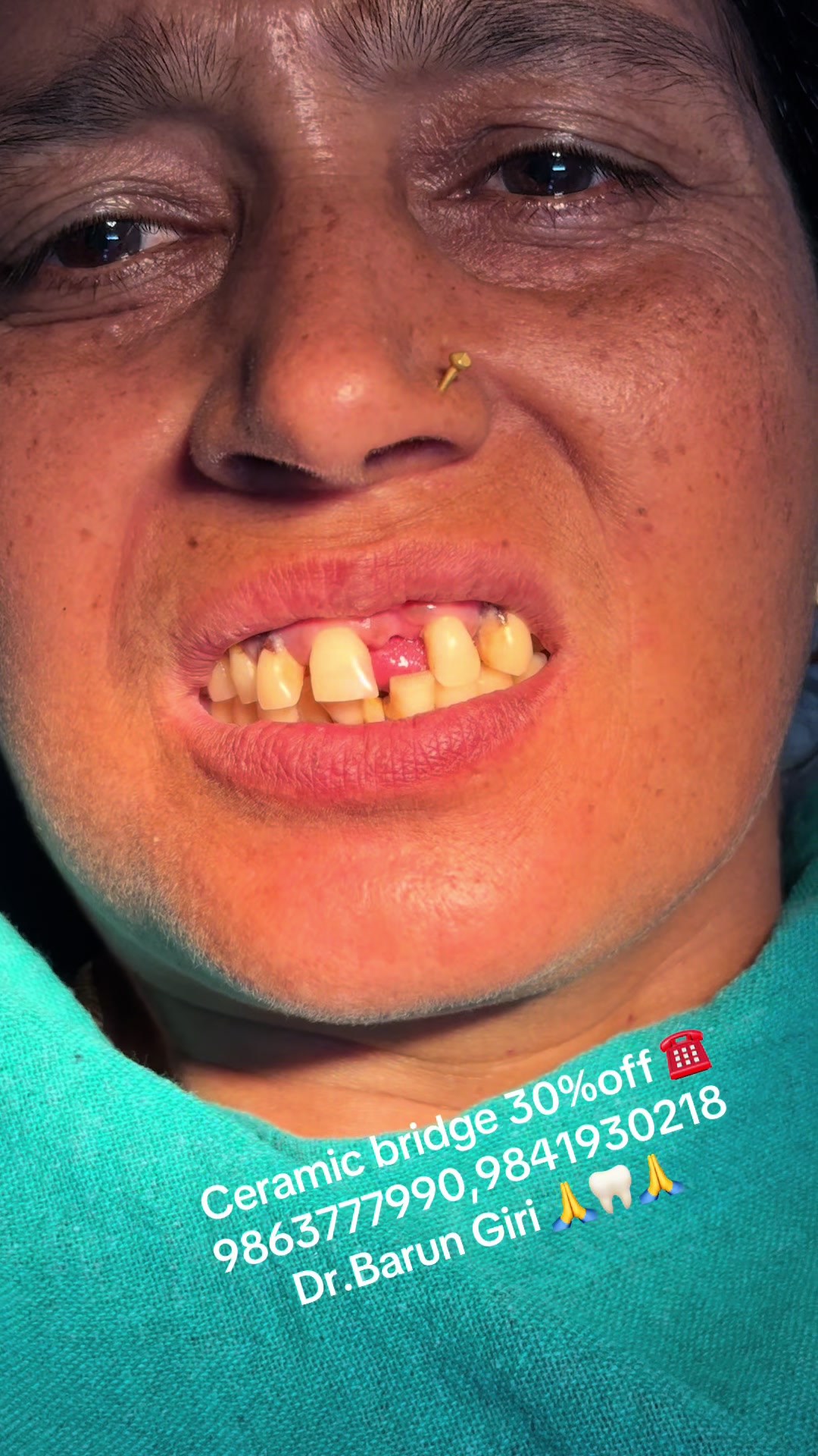 @Unique dental clinic Chabahil
