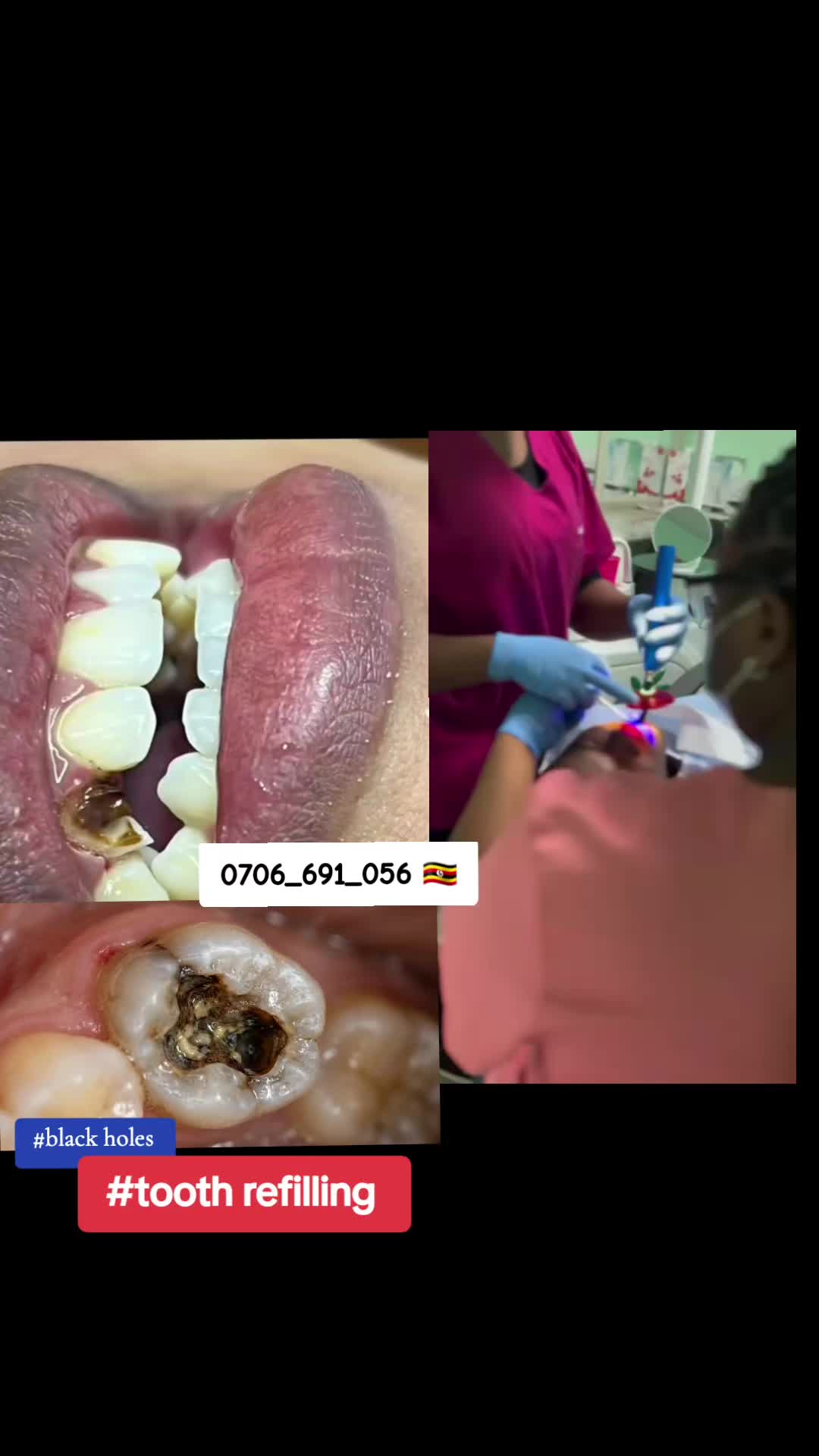 @Dental studio.🦷.Kampala