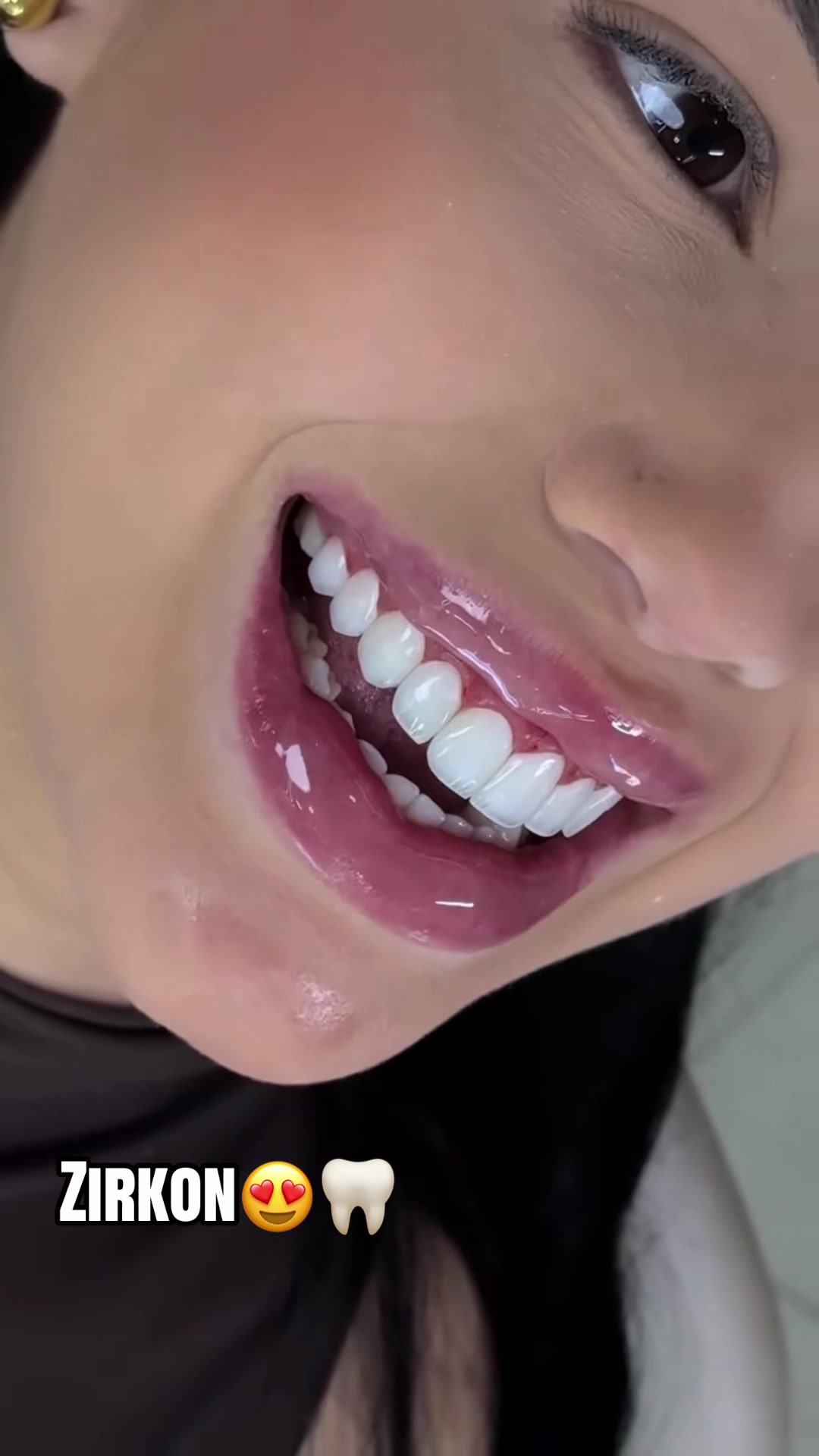 @𝐁𝐚𝐲𝐃𝐞𝐧𝐭𝐄𝐥𝐢𝐭𝐞🦷