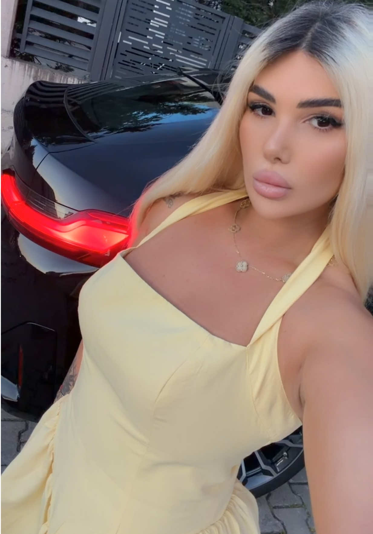 @Arbesa Mehmedaliu