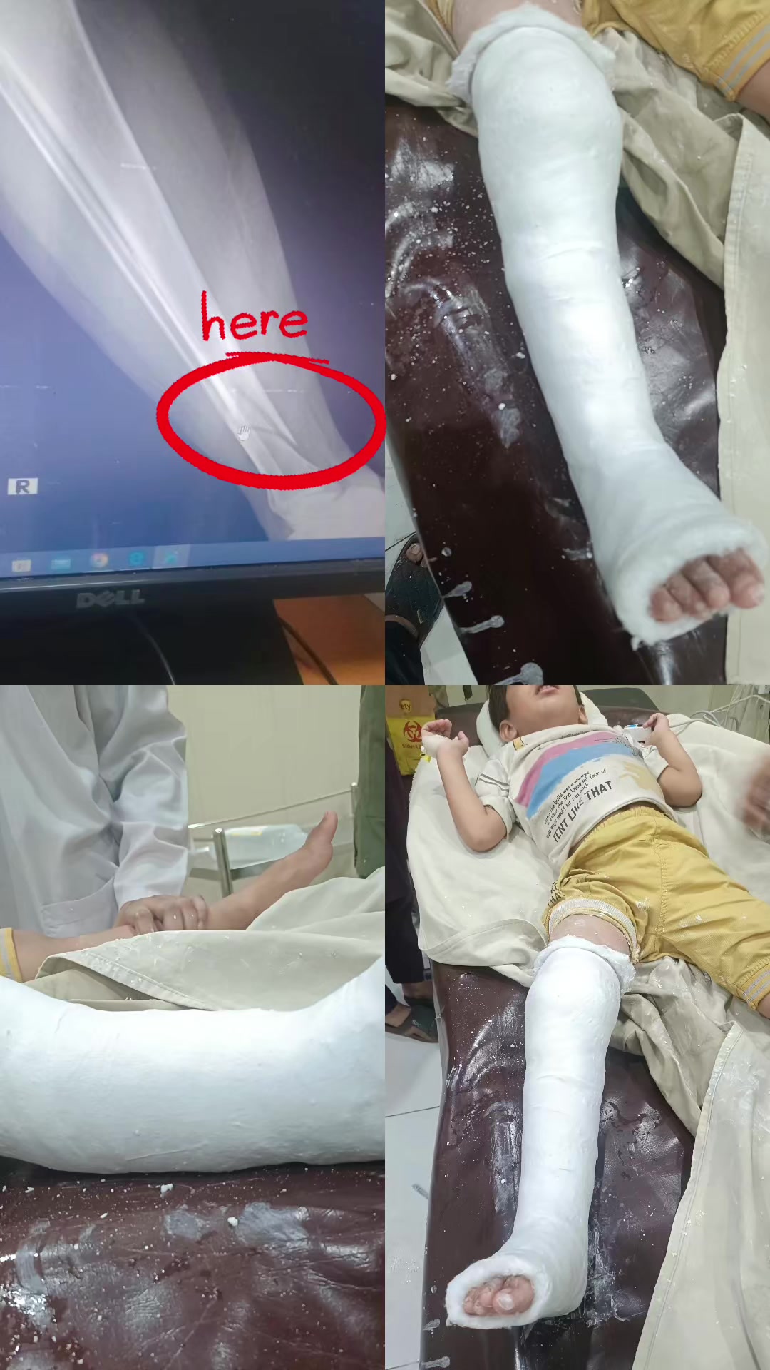 @Dr.Ghazanfar | Ortho Surgeon