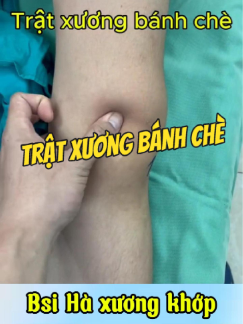 @Chuyên gia xương khớp