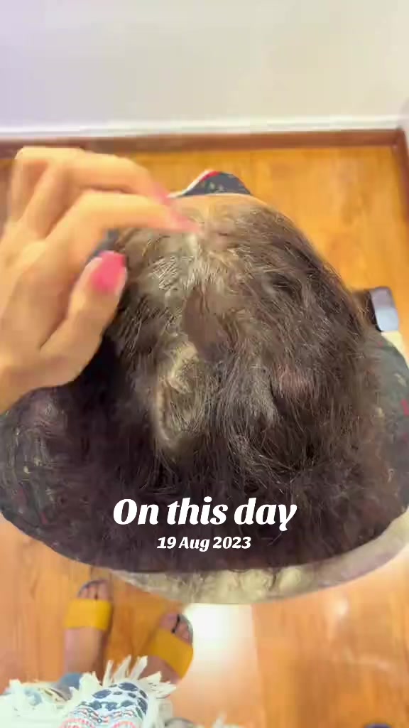 @Hair Stop Nepal Official
