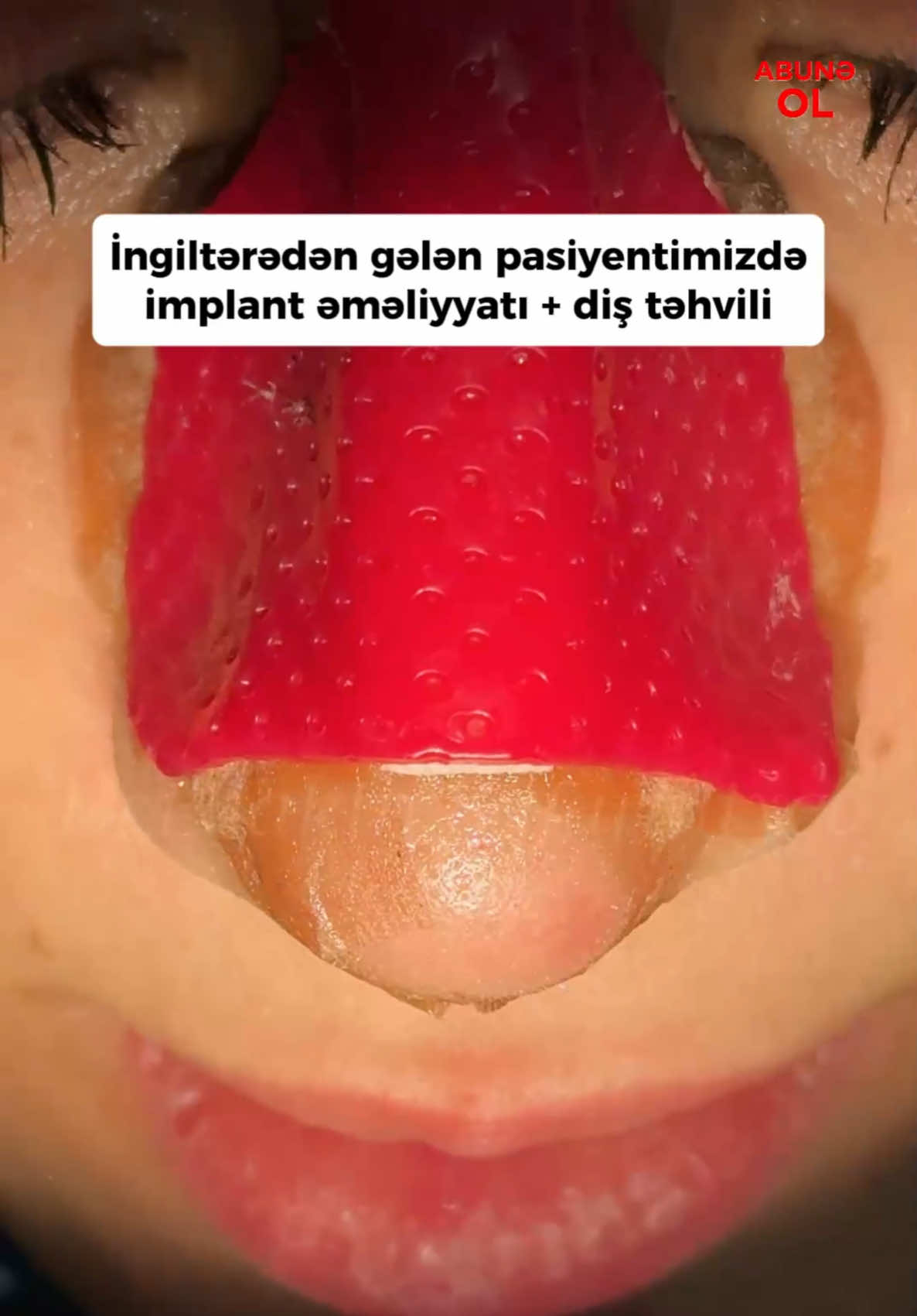 @eltakindentistry