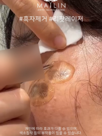 @메이린의원대구점