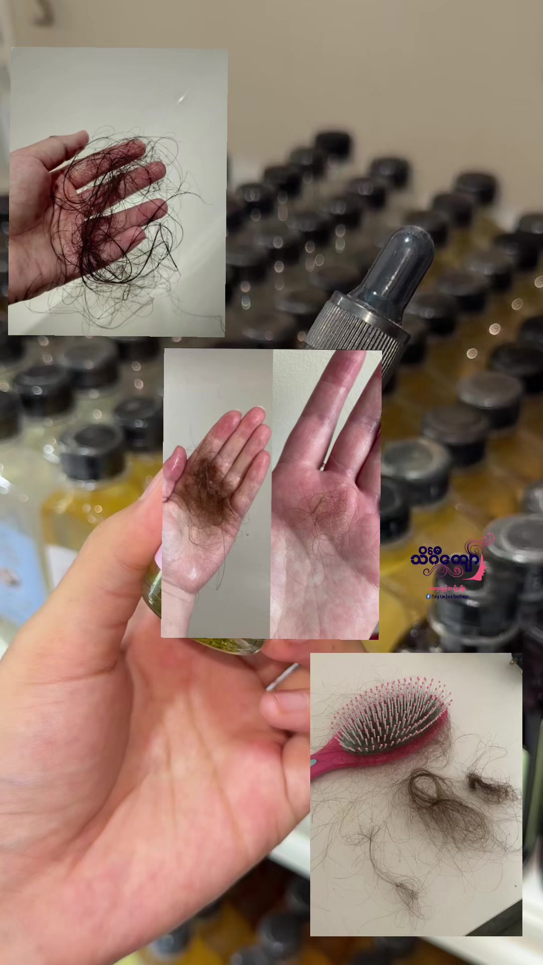@FB: TheingiKyawSkincareShop