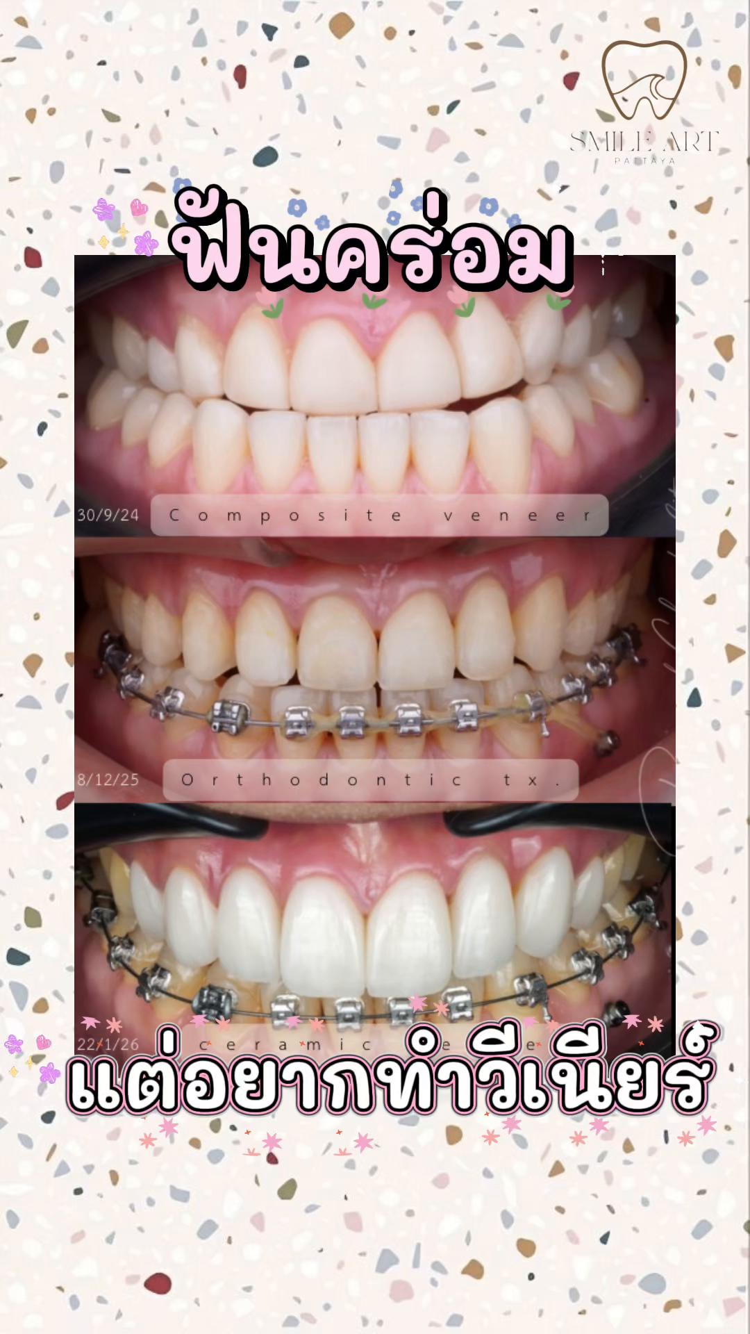 @smile Art Pattaya