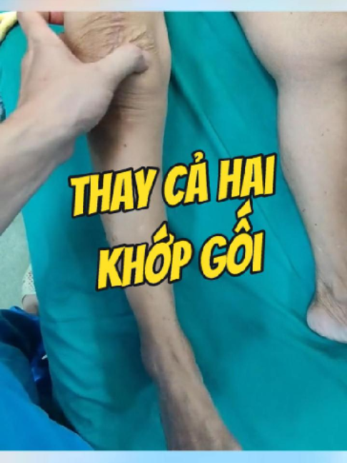 @Chuyên gia xương khớp