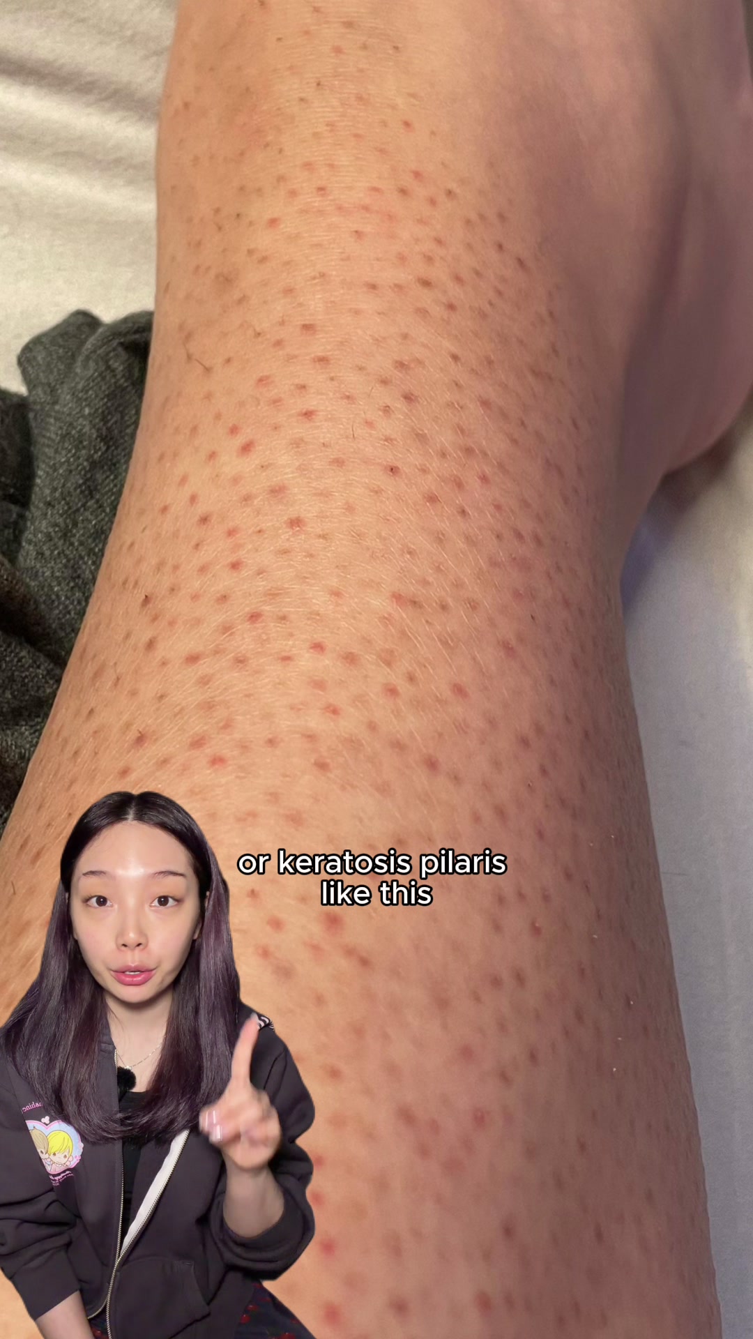 @lily