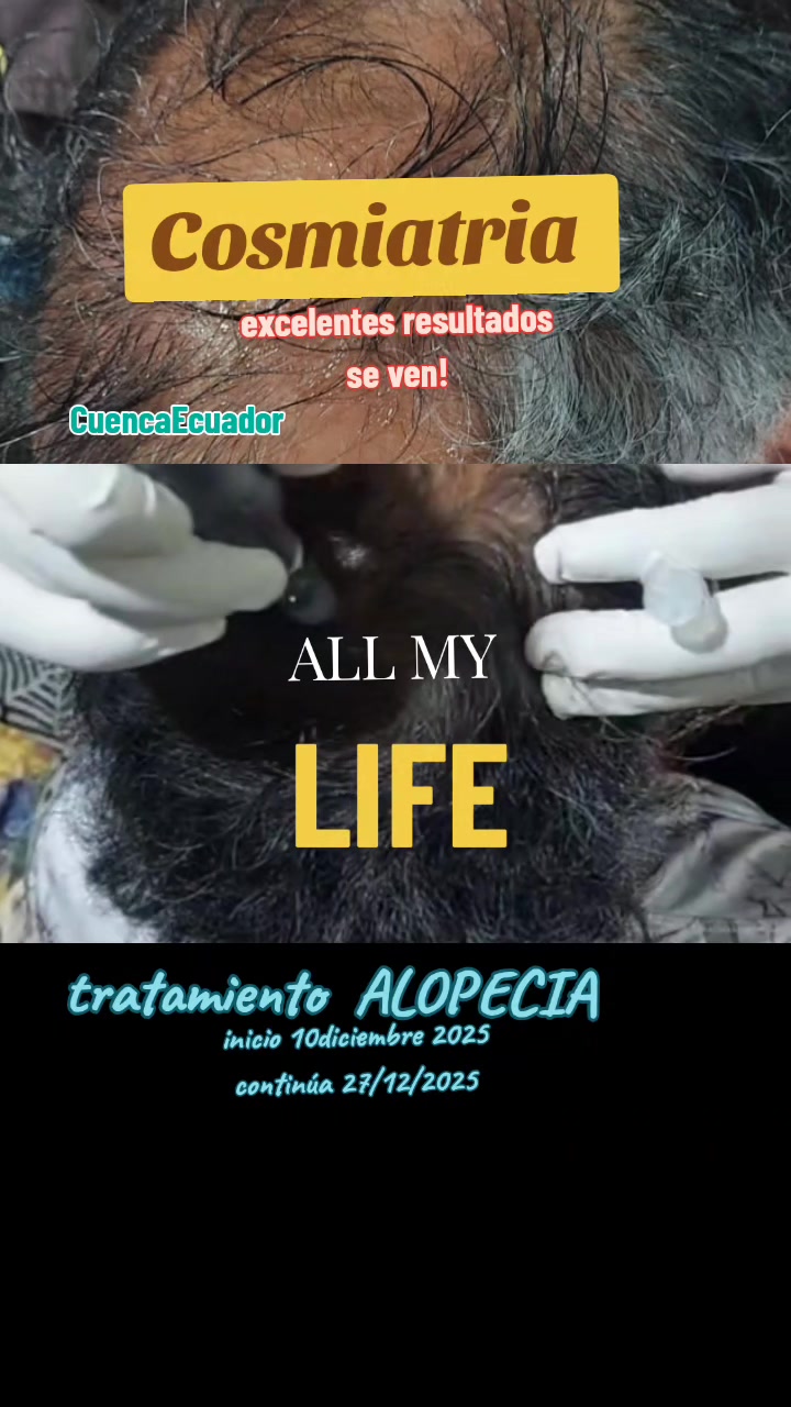 @MeryCampoverde(Neuropsic&oacute;logo)
