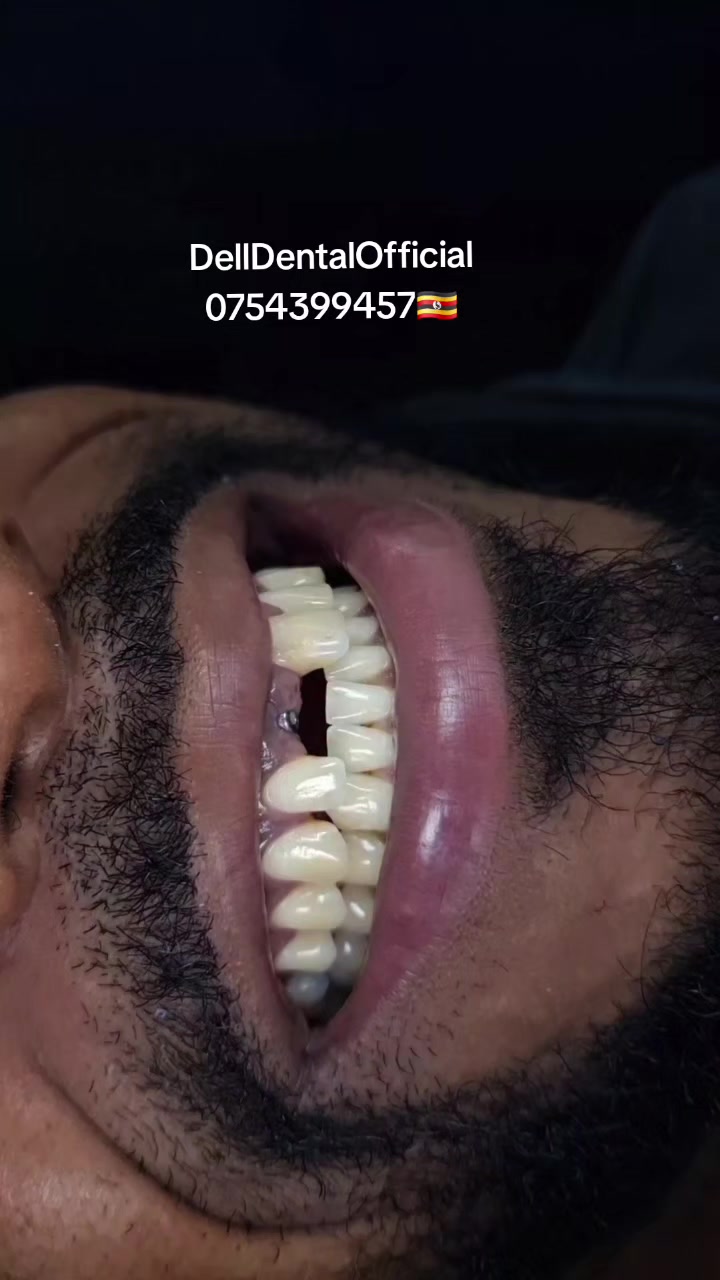 @DellDentalOfficial