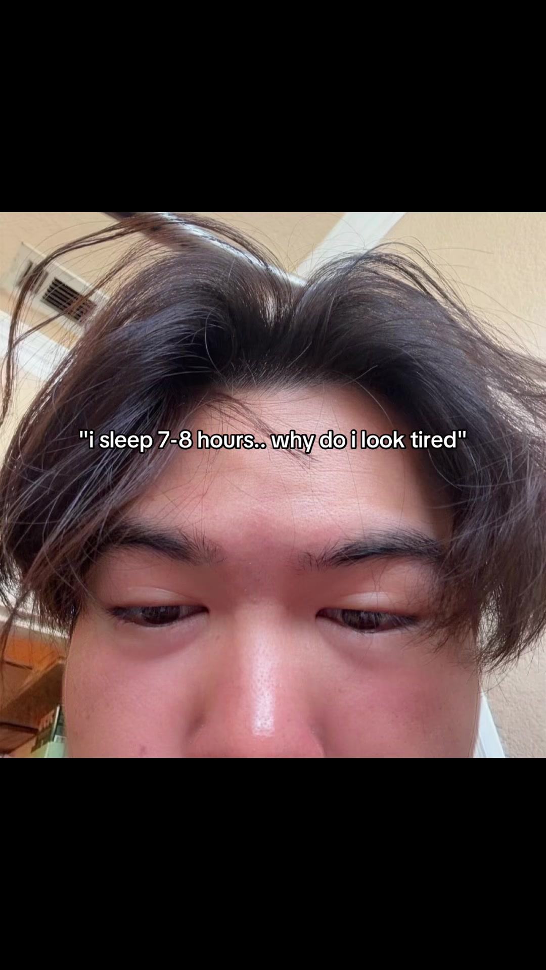 @detected