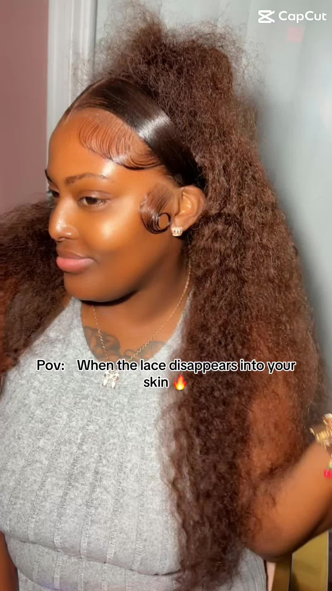 @Lacebyforeignstaxx