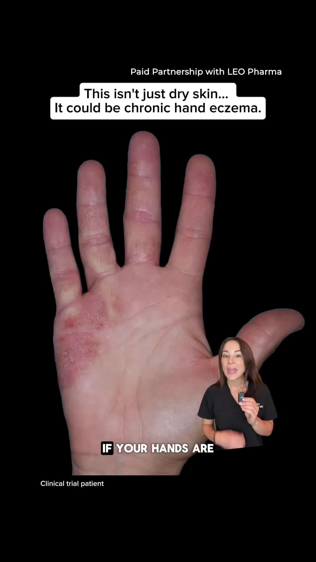 @Dermguru