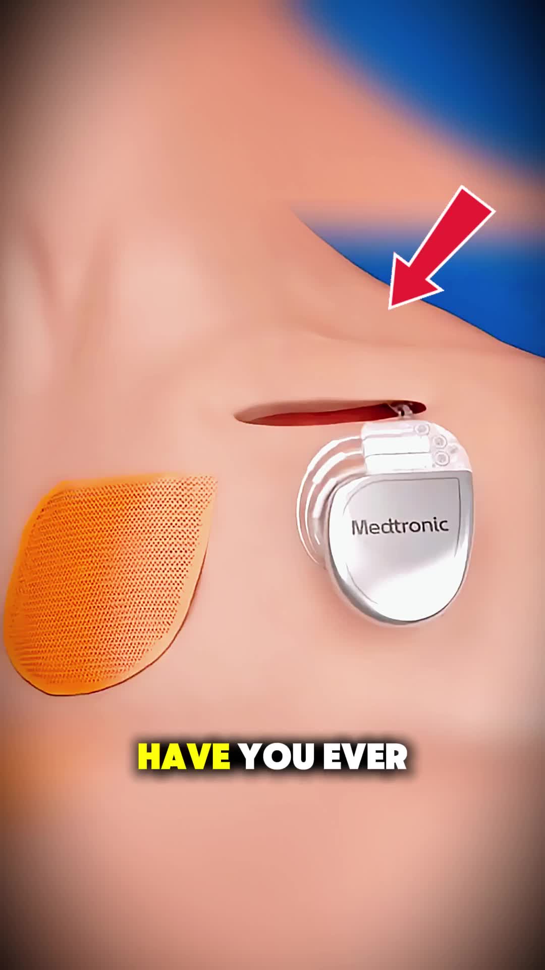 @Human 3D