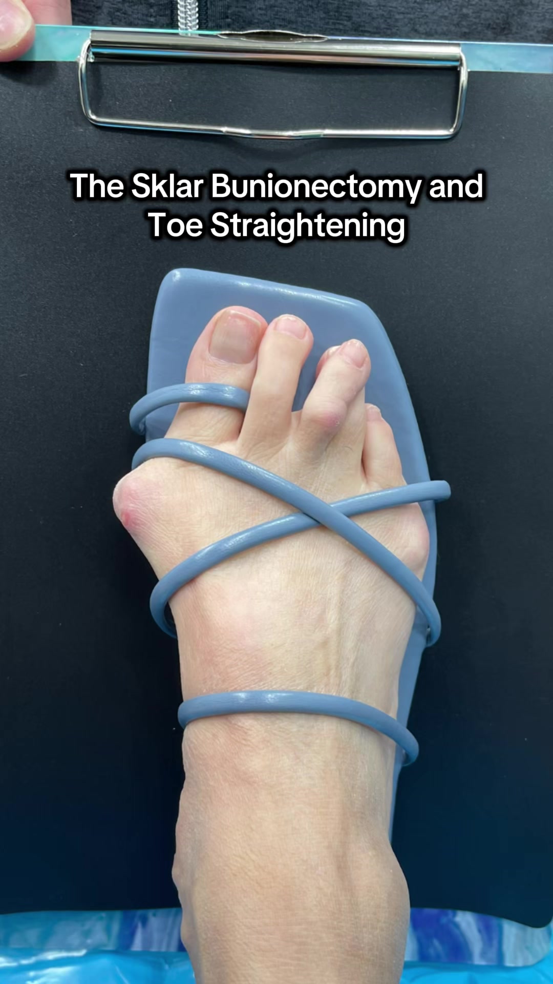 @Foot First Podiatry