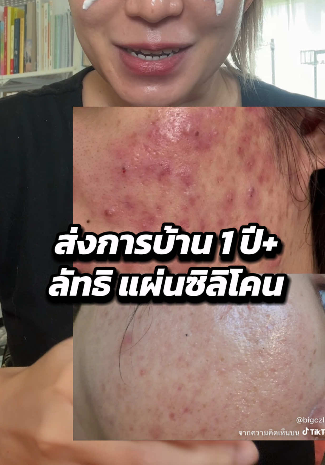 @belittlenerdช่องคุณเตย