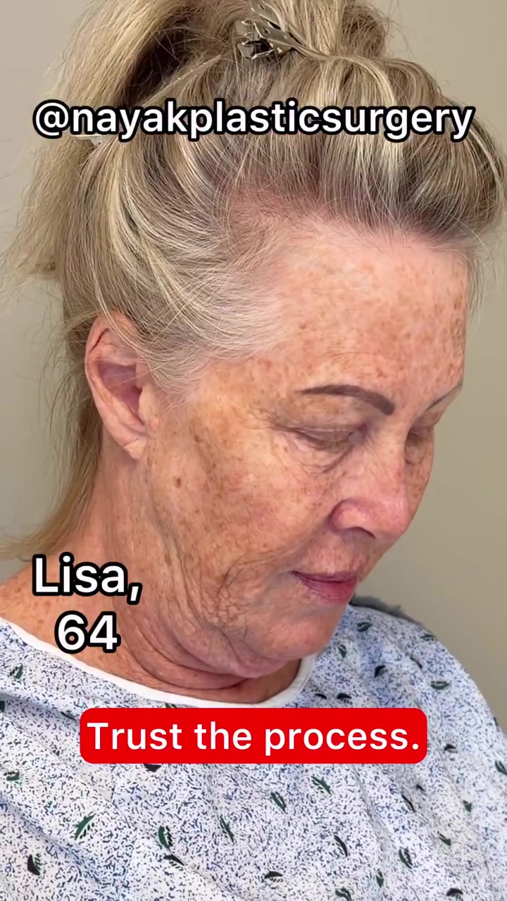 @NayakPlasticSurgery