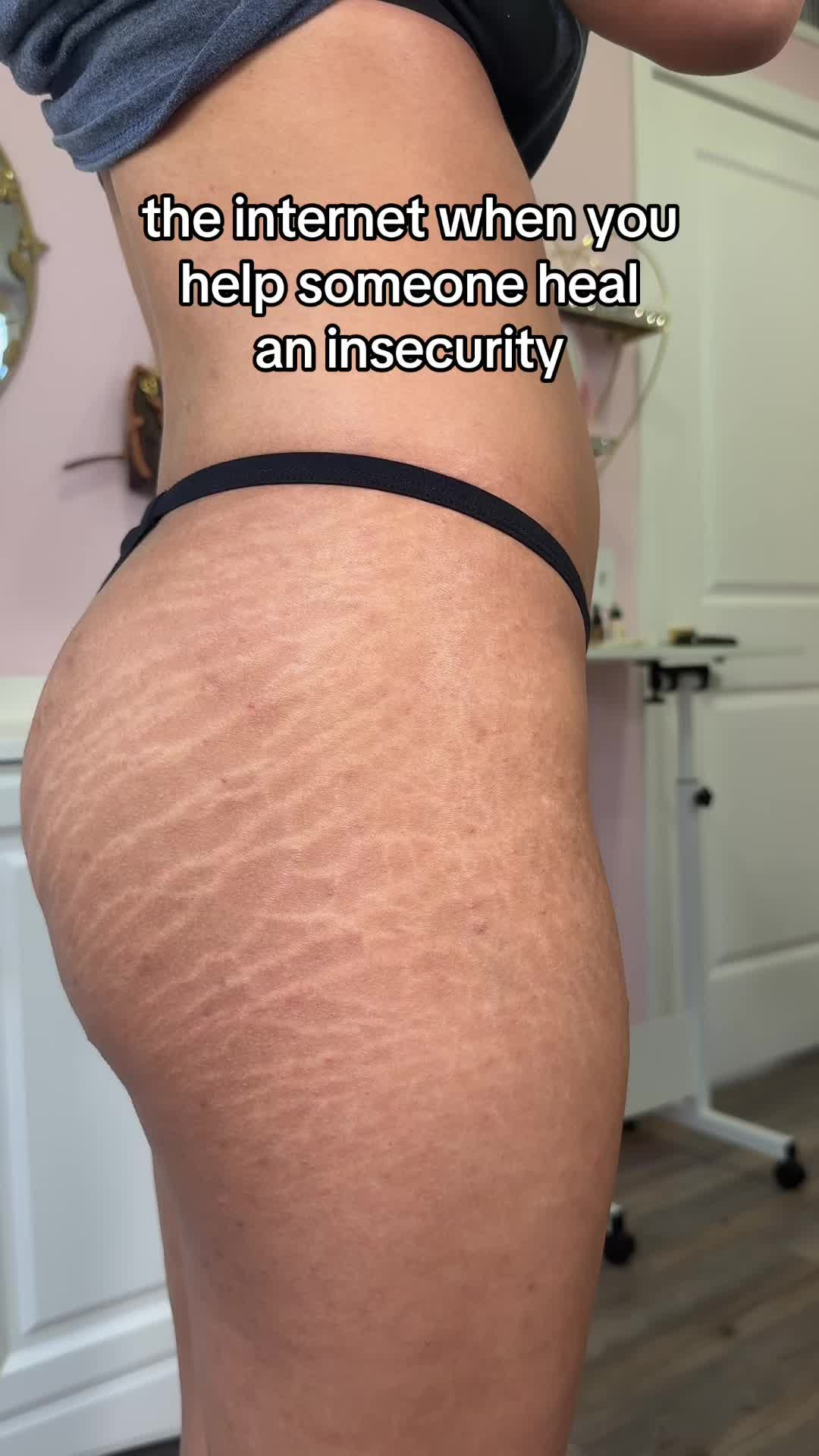 @Stretch Mark Fairy 🧚✨