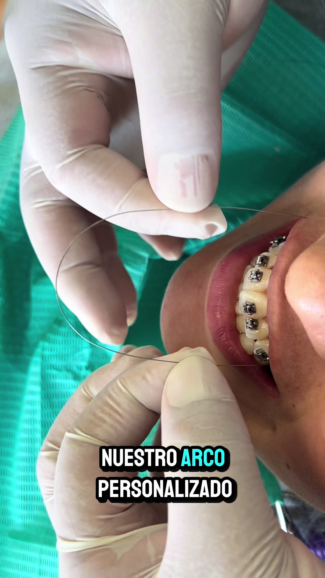 @DentikaBrackets