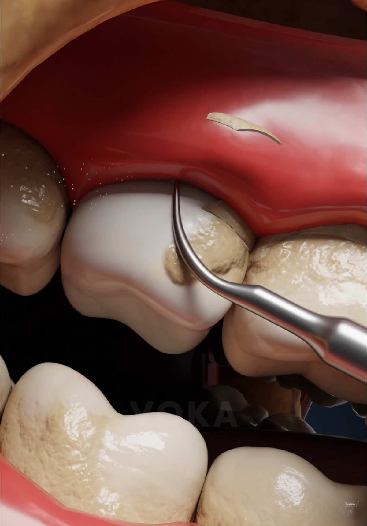 @VOKA 3D Anatomy & Pathology