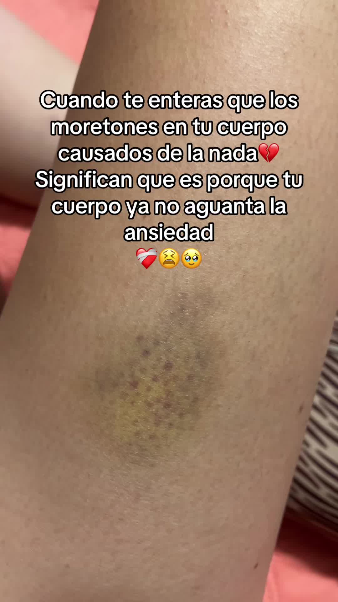 @𝓛𝓪 𝓒𝓱𝓲𝓷𝓪 98🍓