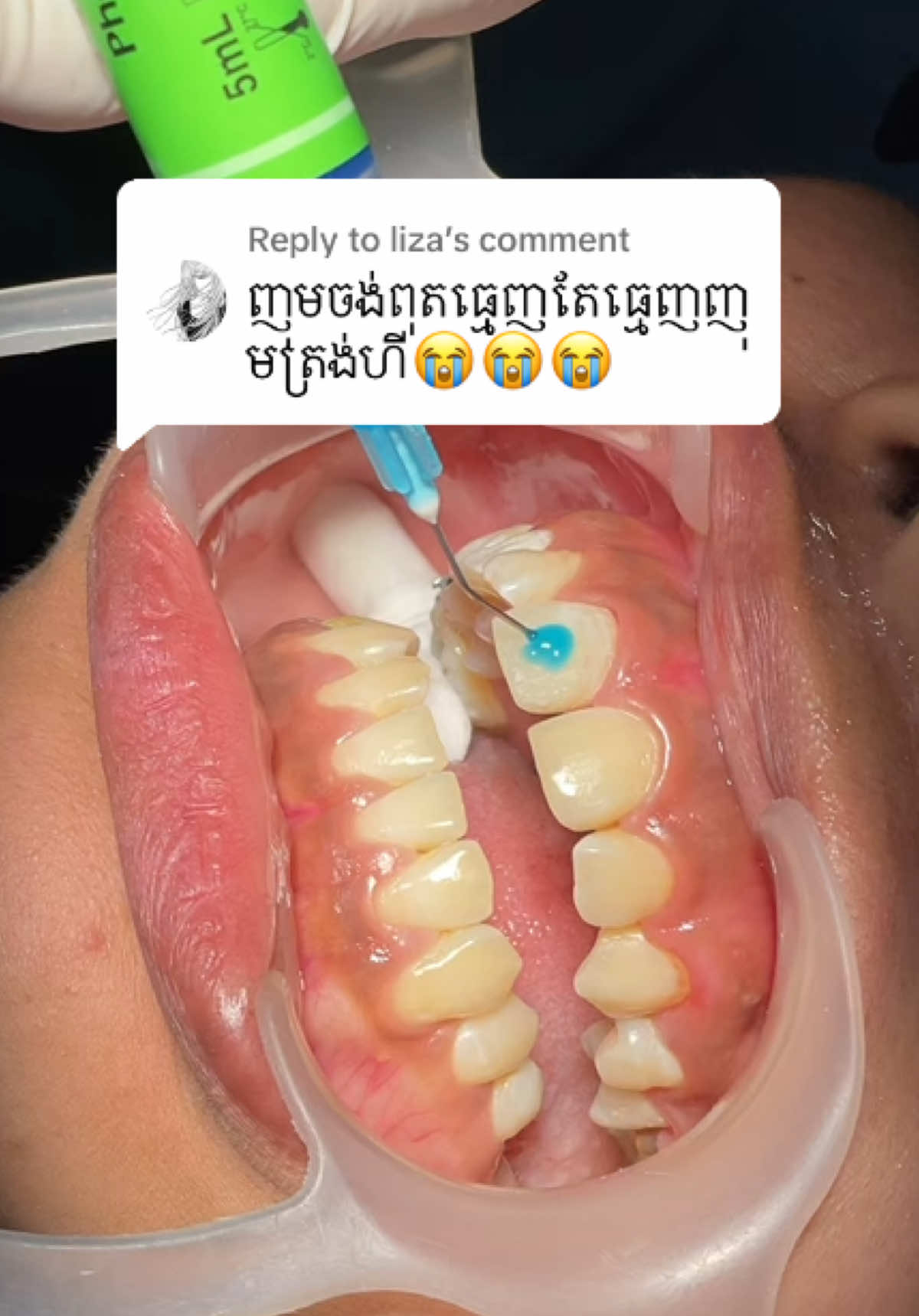 @BRIGHT SMILE DENTAL HOSPITAL
