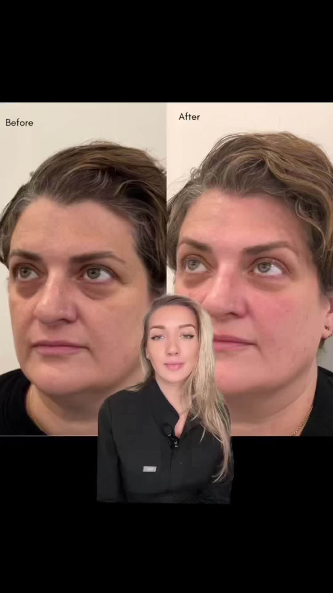 @Glowtox