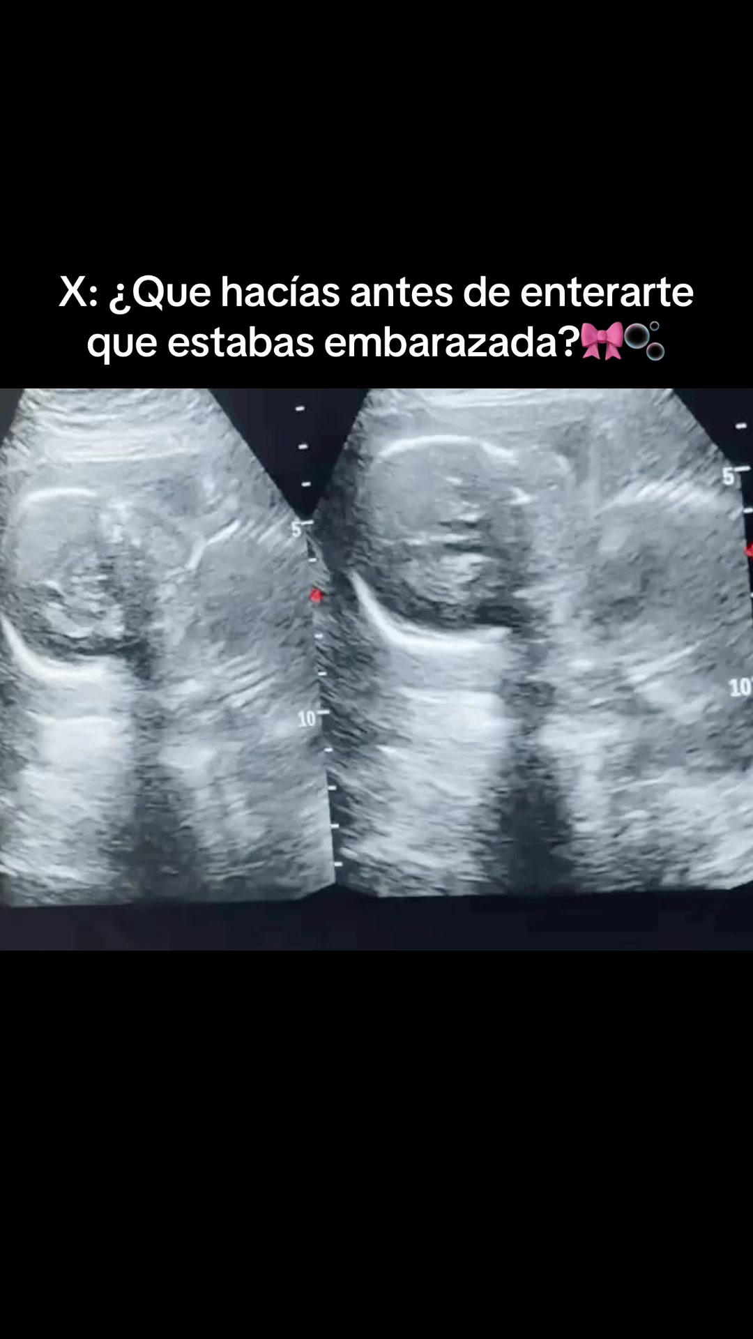 @Mar💕