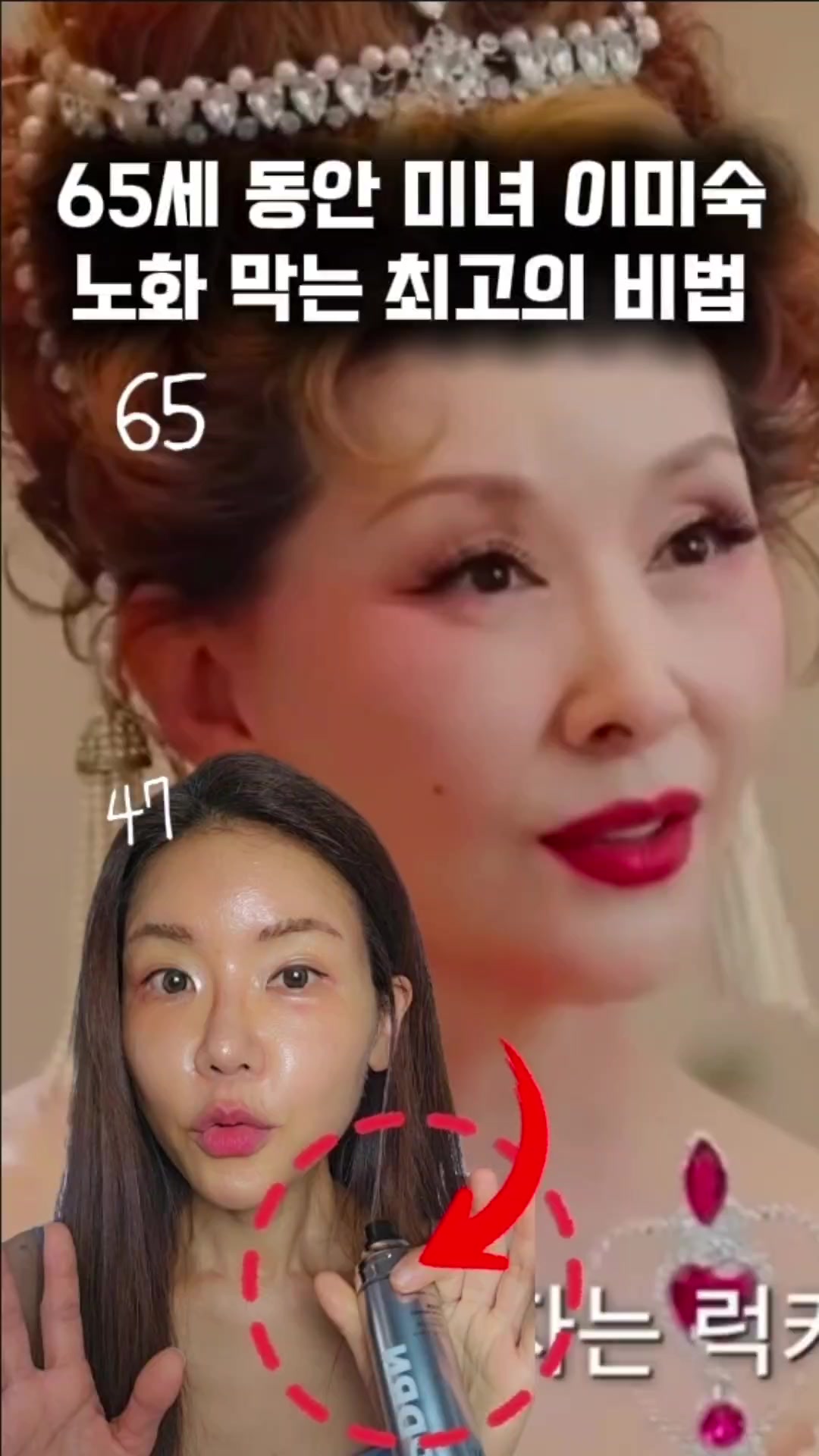 @지나스 GINAS