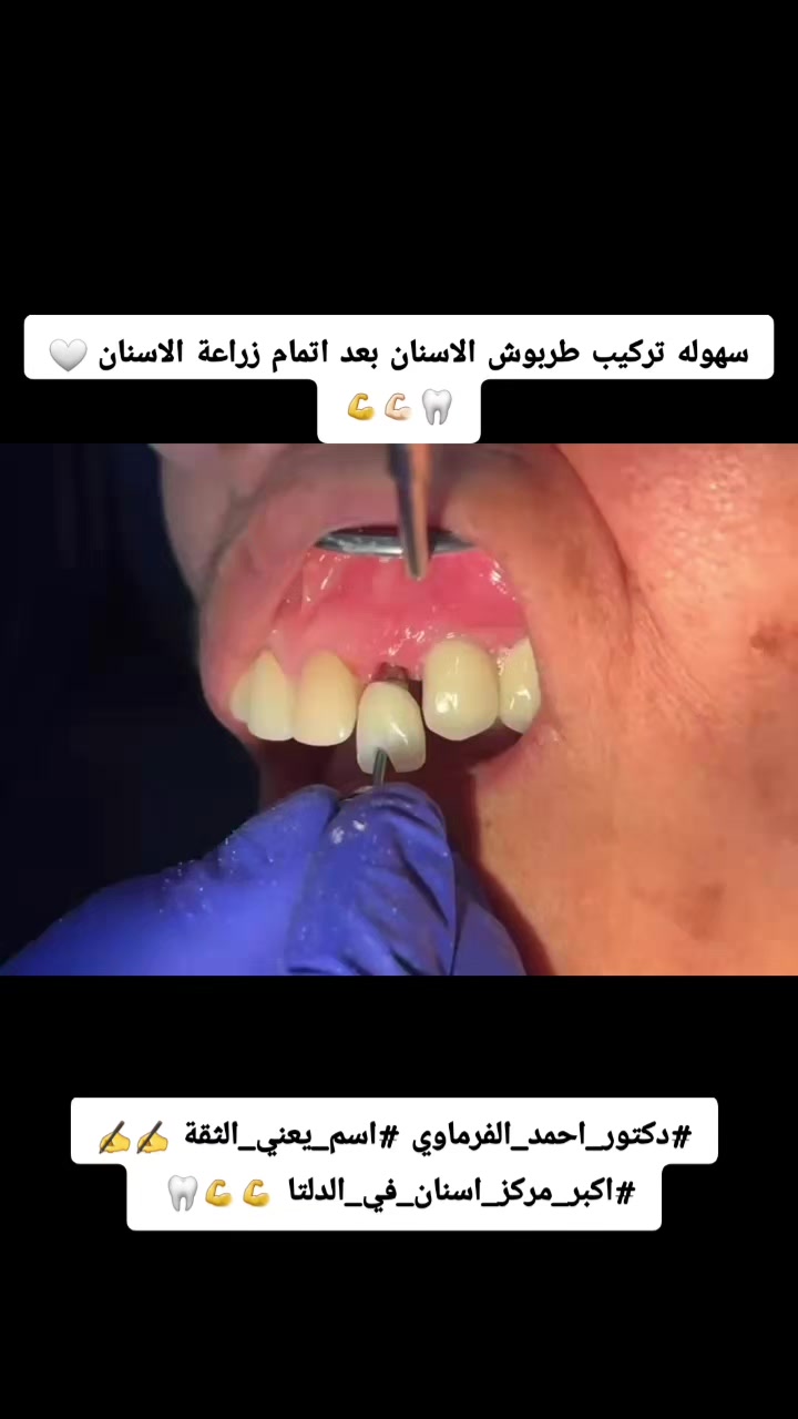@دكتور احمد طلعت الفرماوي