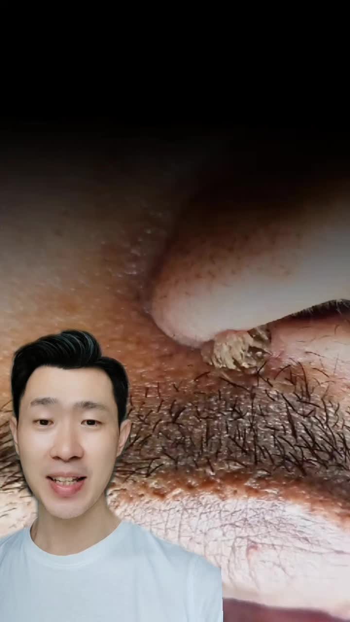 @AskDrLow Dermatologist