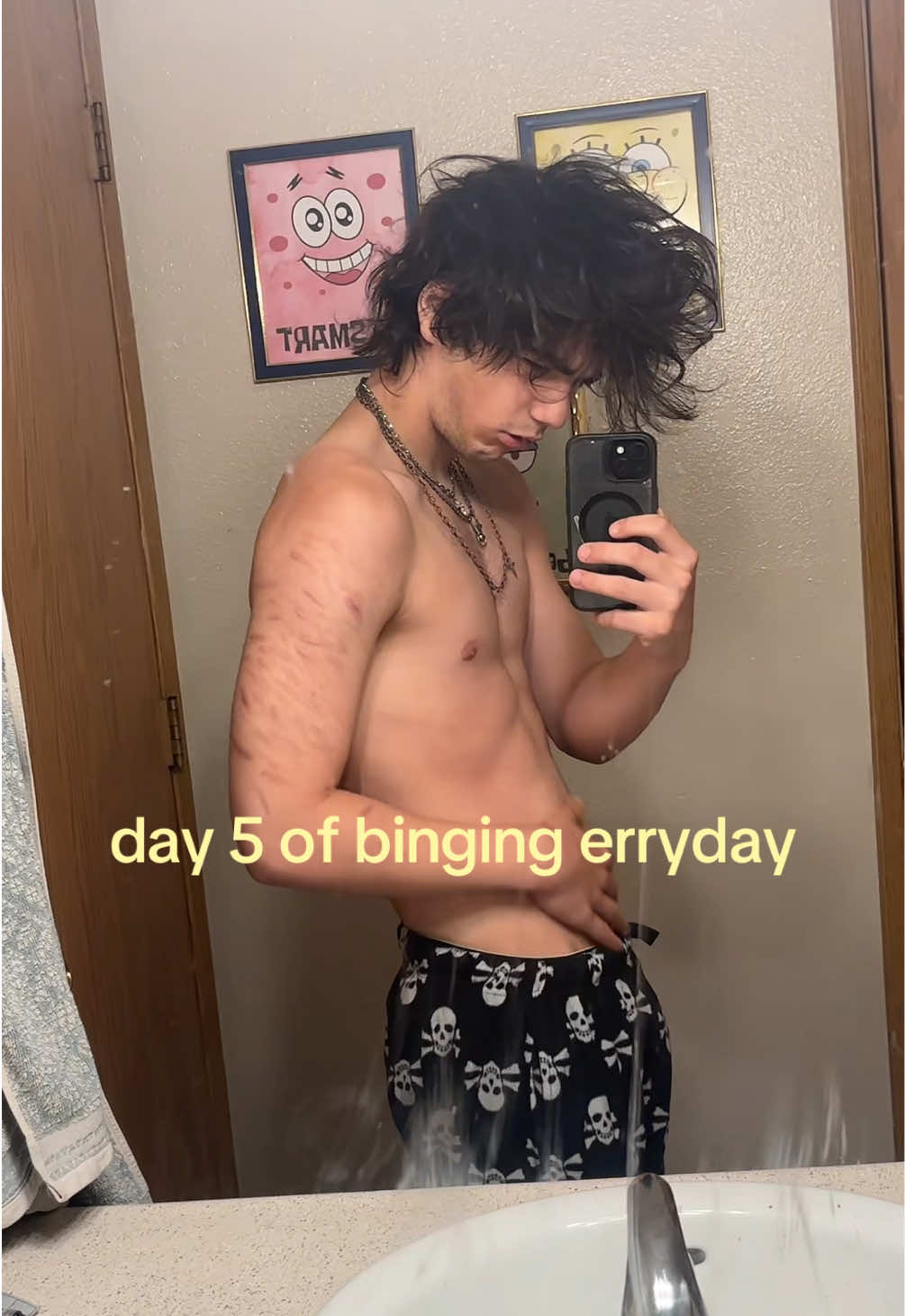 @Binky